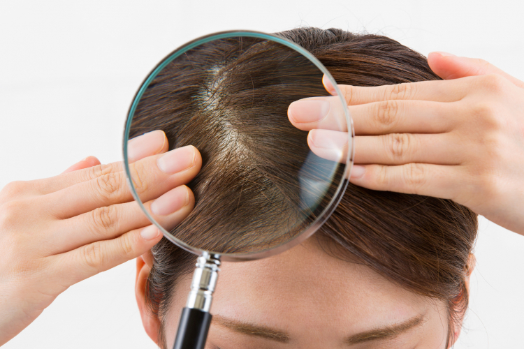 美容師に聞く「薄毛・抜け毛」が気になる女性ヘのヘアケアアドバイス