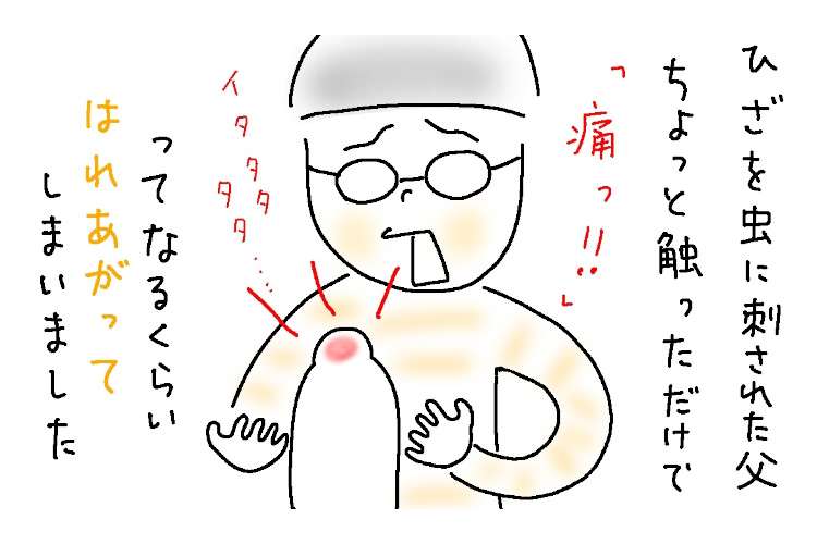 寝相の悪い息子（小4）に、虫刺されで脚が痛い父が“やられた”話【9歳あるある】